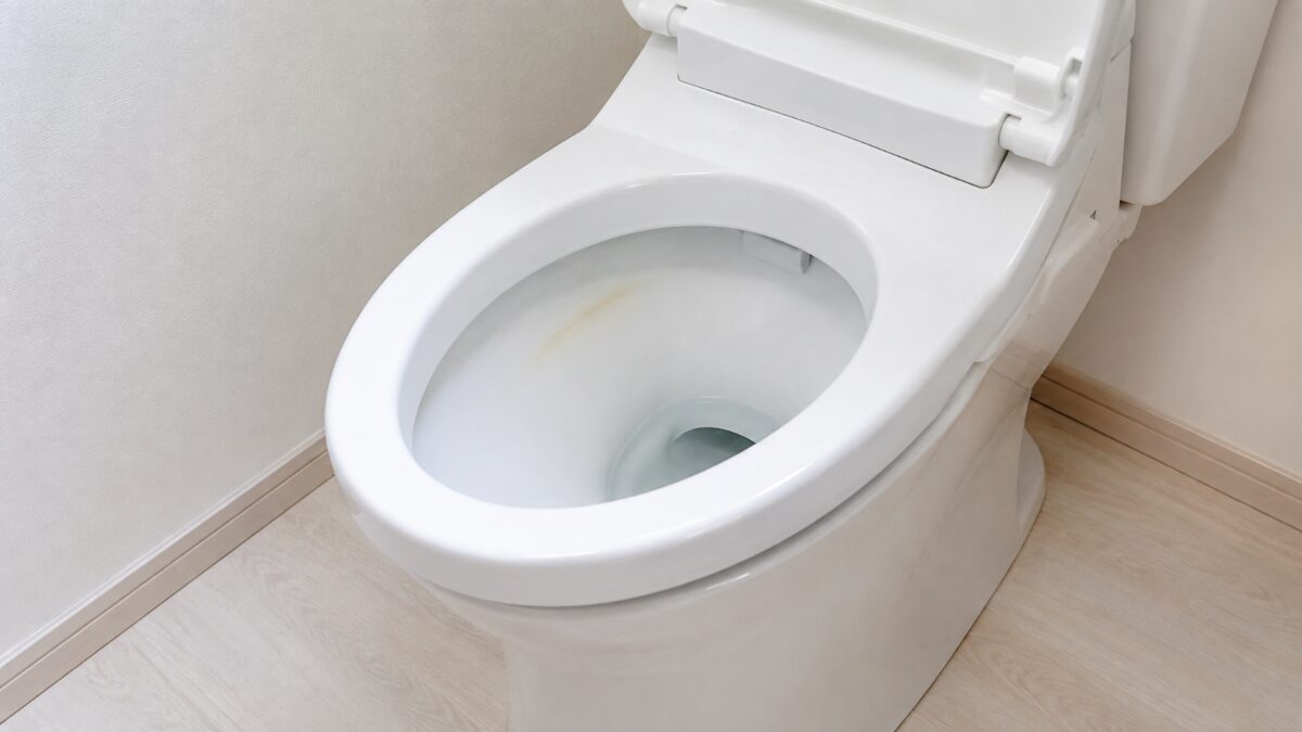トイレの便器内側と便座周辺にある黄色い汚れの付着場所を確認する様子